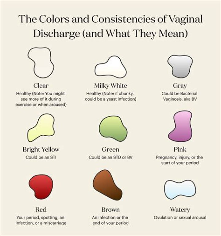 What are the different items rarity colors, and what do they worth at the PNJ's?